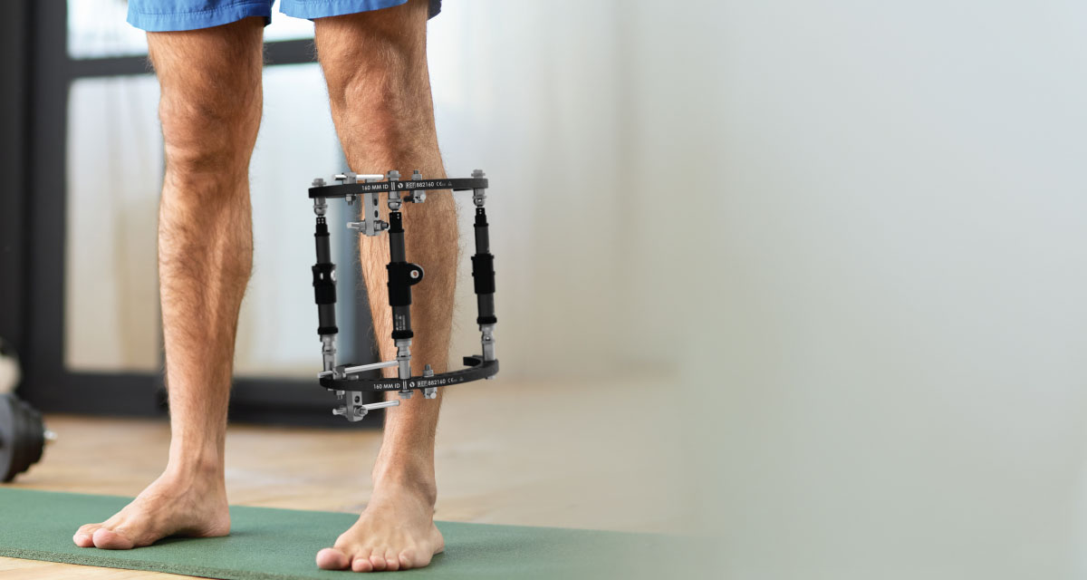 Treatment illustration of deformity